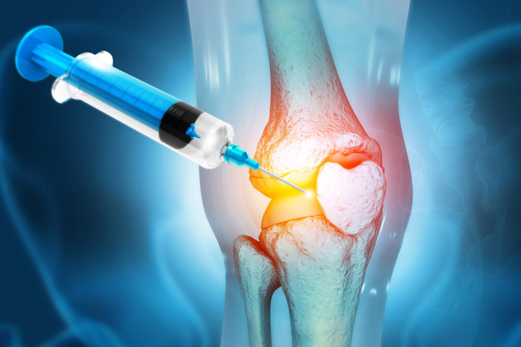 Ostenil Injection For Joints